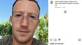 Mark Zuckerberg mit blauen Flecken im Gesicht