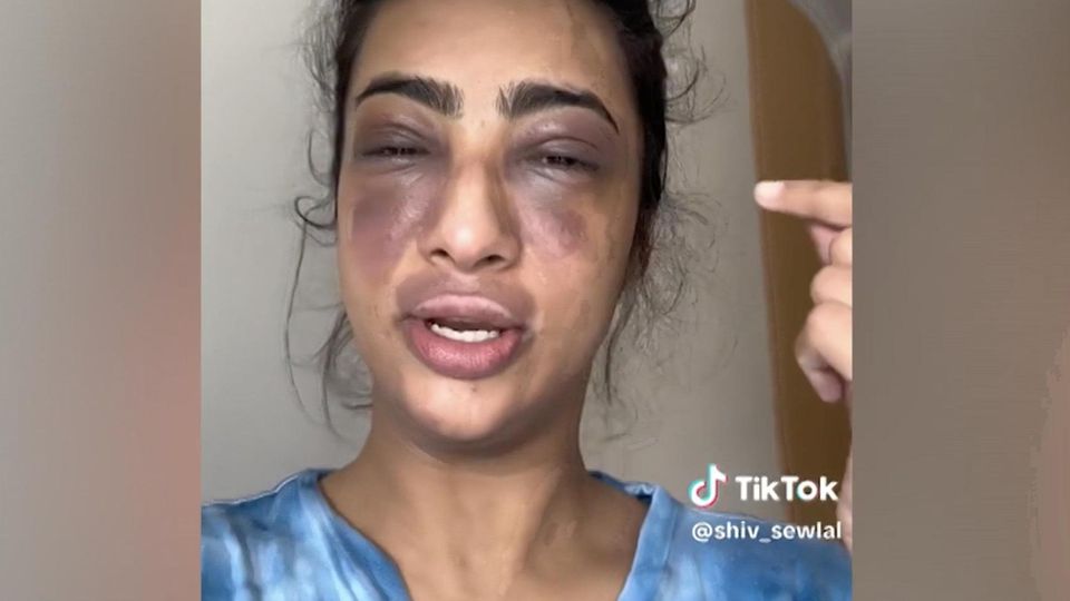 Die Augen von Shiv Sewlal sind so zugeschwollen, dass sie kaum noch sehen kann. Sie konnte sich nicht erklären, woran das liegen könnte, trotzdem geht sie aus einem Bauchgefühl heraus ins Krankenhaus. Wie sich später herausstellen wird, war das ihre Rettung in letzter Sekunde.