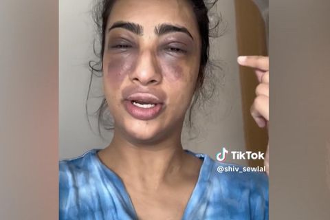 Die Augen von Shiv Sewlal sind so zugeschwollen, dass sie kaum noch sehen kann. Sie konnte sich nicht erklären, woran das liegen könnte, trotzdem geht sie aus einem Bauchgefühl heraus ins Krankenhaus. Wie sich später herausstellen wird, war das ihre Rettung in letzter Sekunde.