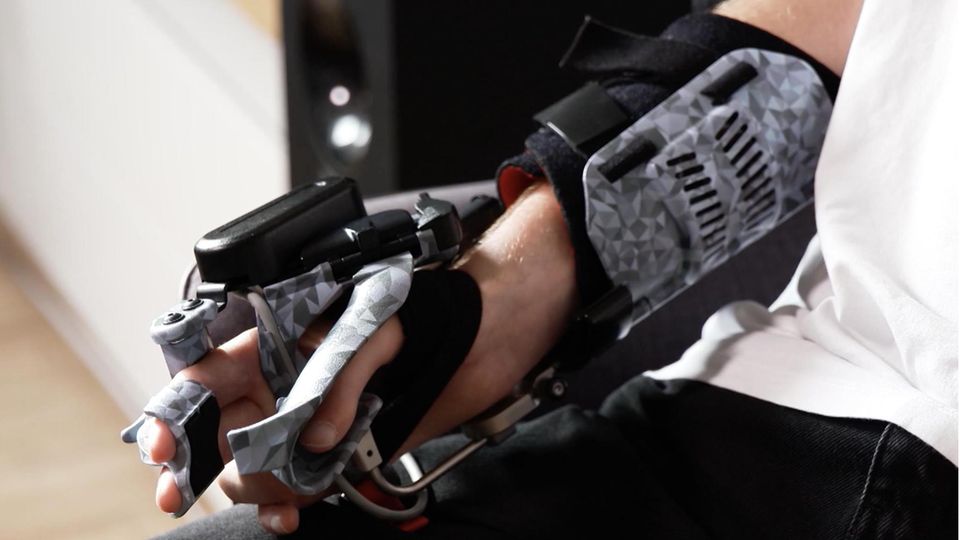 Nach Motorradunfall: Mann lebt nun mit einer Arm-Orthese