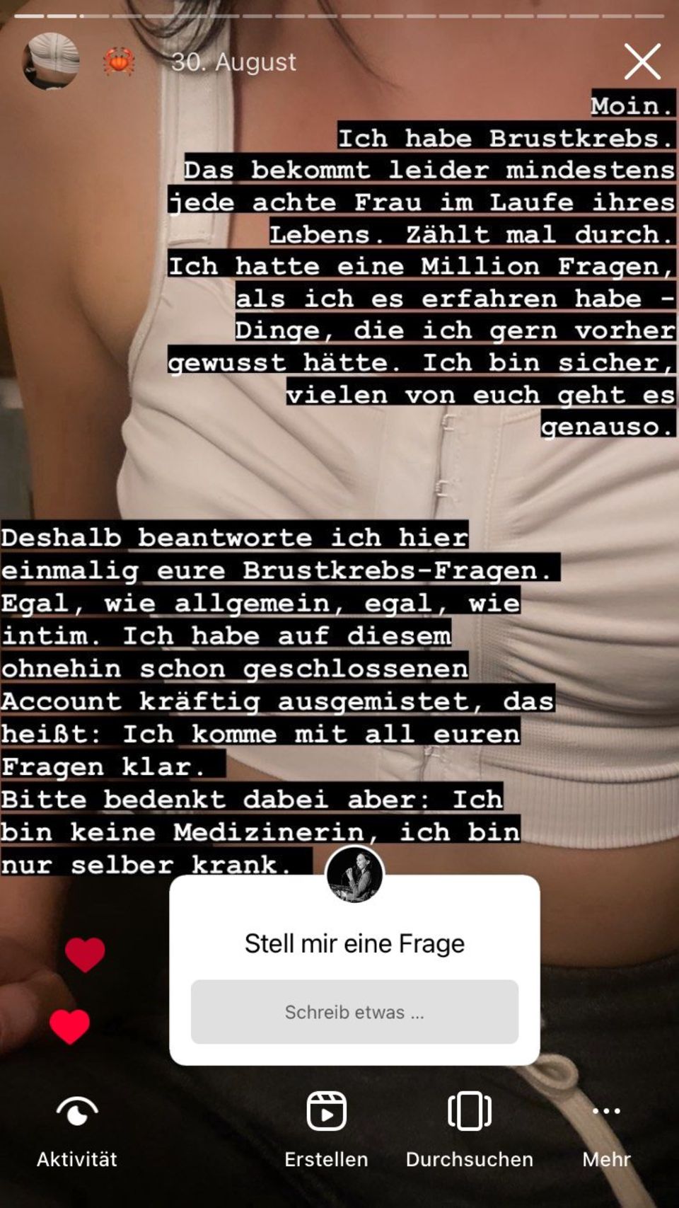 Oberkörper von Jenny im Kompressionsmieder