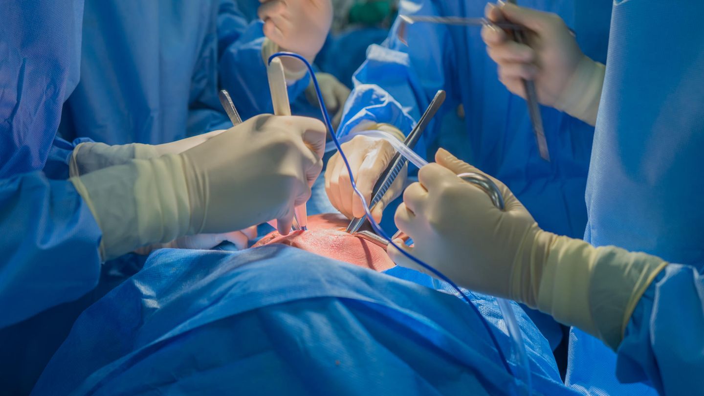 Ärzte im OP als Symbolfoto für eine Schweineherz-Transplantation