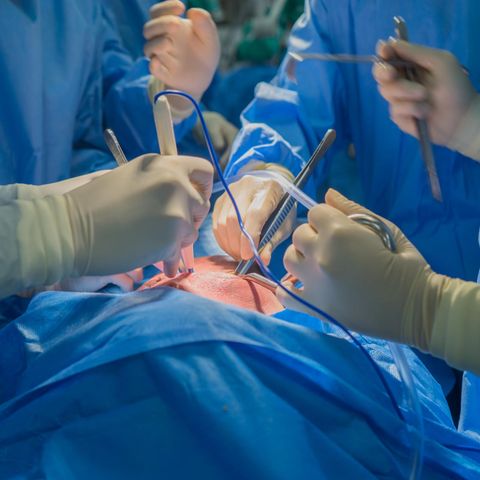 Ärzte im OP als Symbolfoto für eine Schweineherz-Transplantation