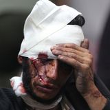 Anblick des Grauens. Ein schwerverletzter Palästinenser fasst sich mit der Hand an den Kopf, der mit einem weißen Verband umhüllt ist. Sein Gesicht ist blutverschmiert.