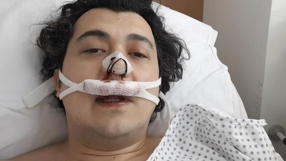 Volkskrankheit Schnarchen: Reporter macht Selbstexperiment: Lohnt sich die riskante Operation gegen das Schnarchen?