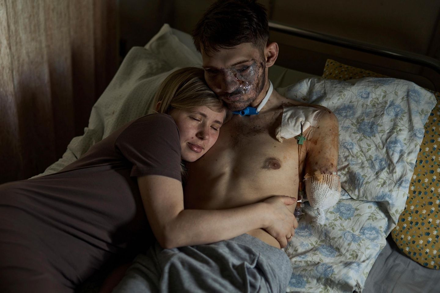 Ukraine Eine Frau und ihr durch den Krieg schwerverletzter Ehemann liegen im Krankenhaus Bett