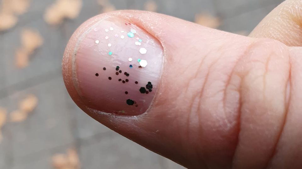 Thumb with glitter on the nail