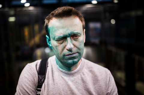 Alexej Nawalny mit grüner Farbe im Gesicht