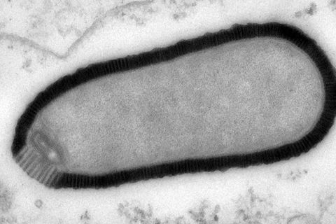Erreger im Permafrost: Pithovirus sibericum