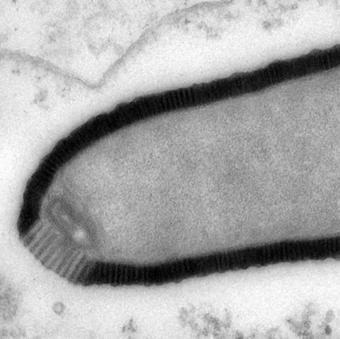 Erreger im Permafrost: Pithovirus sibericum