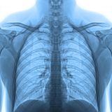 Röntgenbild des Oberkörpers auf weißem Hintergrund