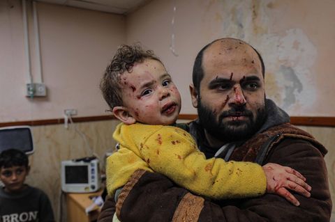 Ein bei israelischen Luftangriffen verletzter Palästinenser steht am Donnerstag mit seinem Kind im Al-Aksa-Krankenhaus