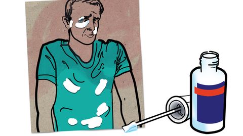 Die Diagnose: Ein Illustration zeigt einen Mann mit weißen Flecken im Gesicht