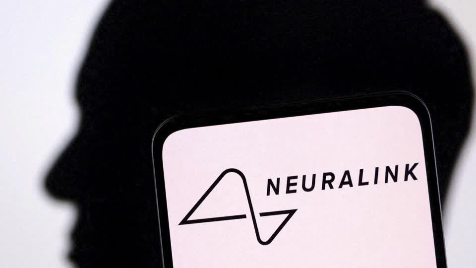 Video: Neuralink implantiert erstmals Gehirnchip beim Menschen Video: Neuralink implantiert erstmals Gehirnchip beim Menschen