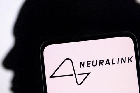 Video: Neuralink implantiert erstmals Gehirnchip beim Menschen
