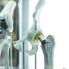 Hüftchirurgie: Das sind ausgezeichnete Ärzte 2024