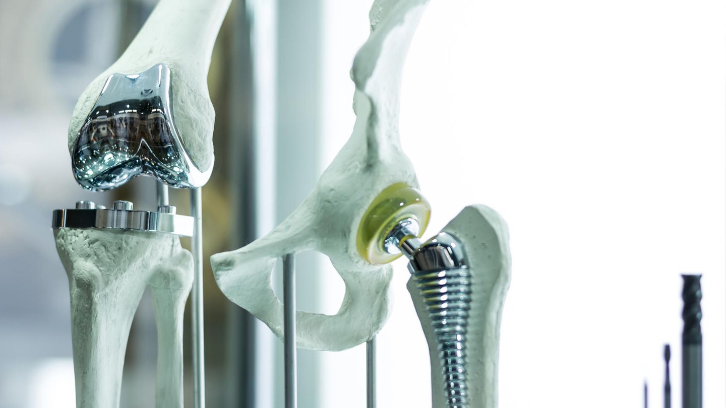Hüftchirurgie: Das sind ausgezeichnete Ärzte 2024