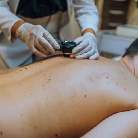 Hautkrebs: Das sind ausgezeichnete Ärzte 2024