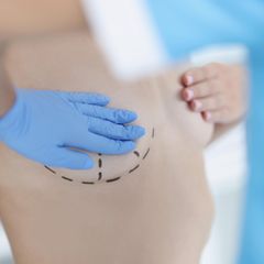 Das sind ausgezeichnete Ärzte im Bereich Brustchirurgie 