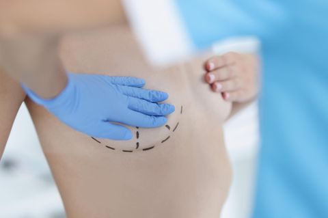Das sind ausgezeichnete Ärzte im Bereich Brustchirurgie 