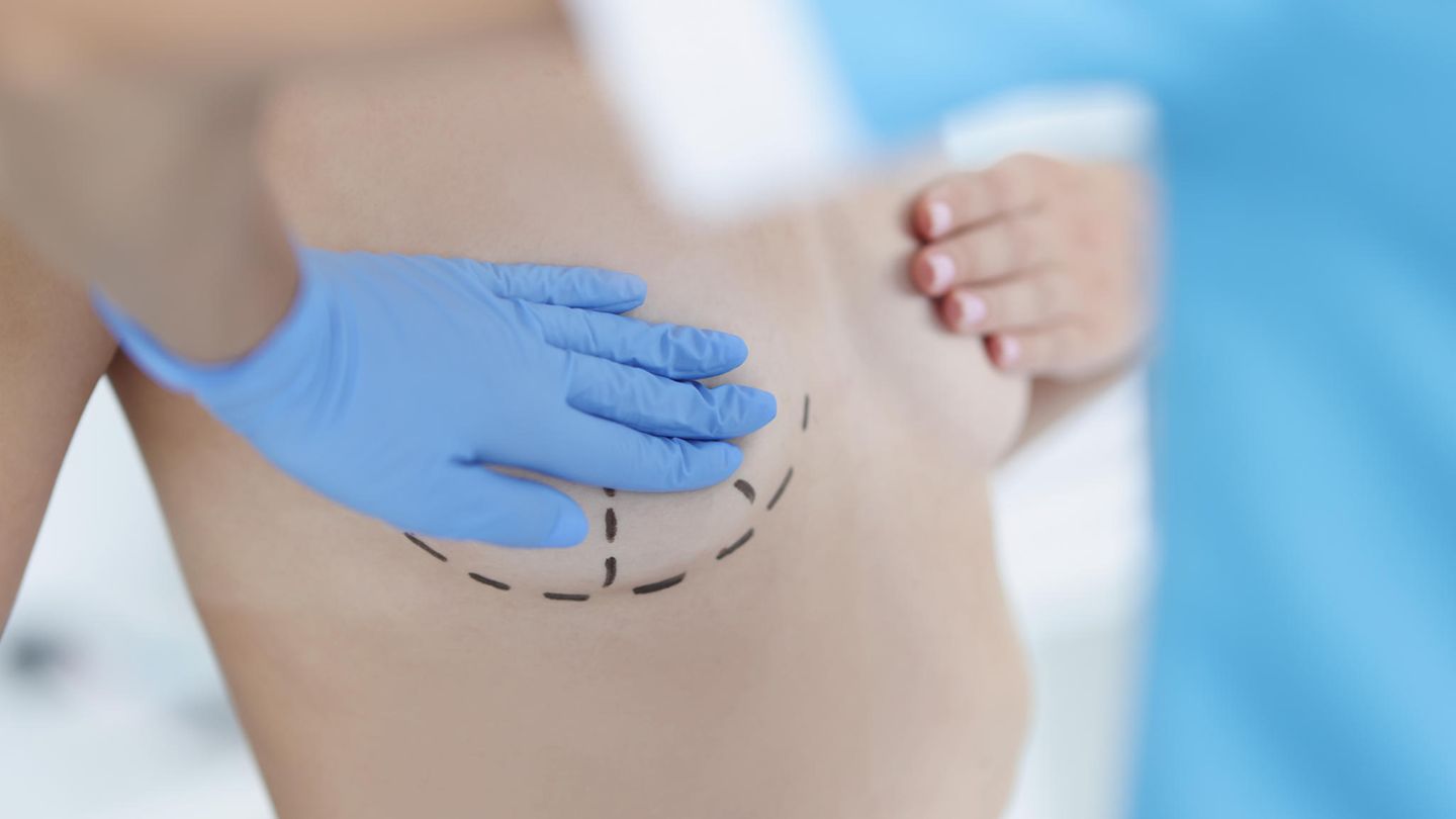 Das sind ausgezeichnete Ärzte im Bereich Brustchirurgie 