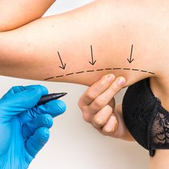 Das sind ausgezeichnete Ärzte im Bereich Ganzkörperstraffung 