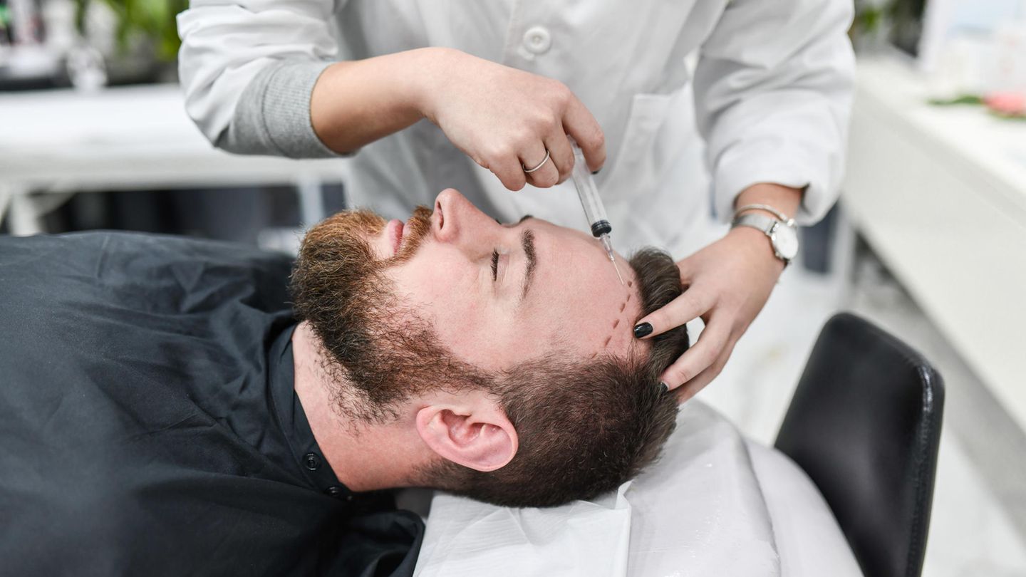 Das sind ausgezeichnete Ärzte im Bereich Haartransplantation 