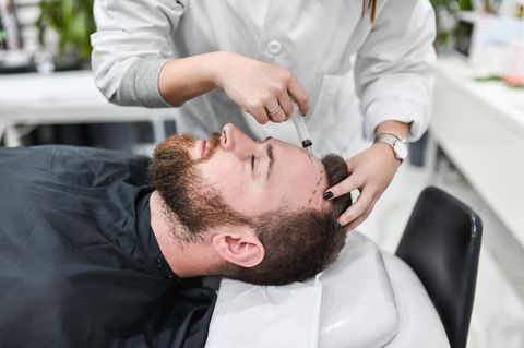 Das sind ausgezeichnete Ärzte im Bereich Haartransplantation 