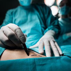 Das sind ausgezeichnete Ärzte im Bereich Liposuktion 