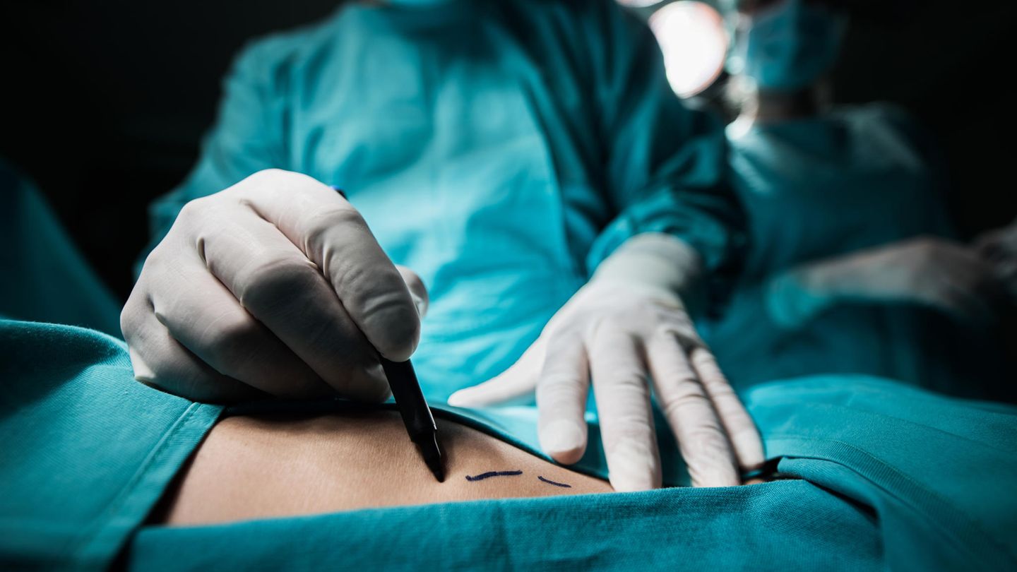 Das sind ausgezeichnete Ärzte im Bereich Liposuktion 