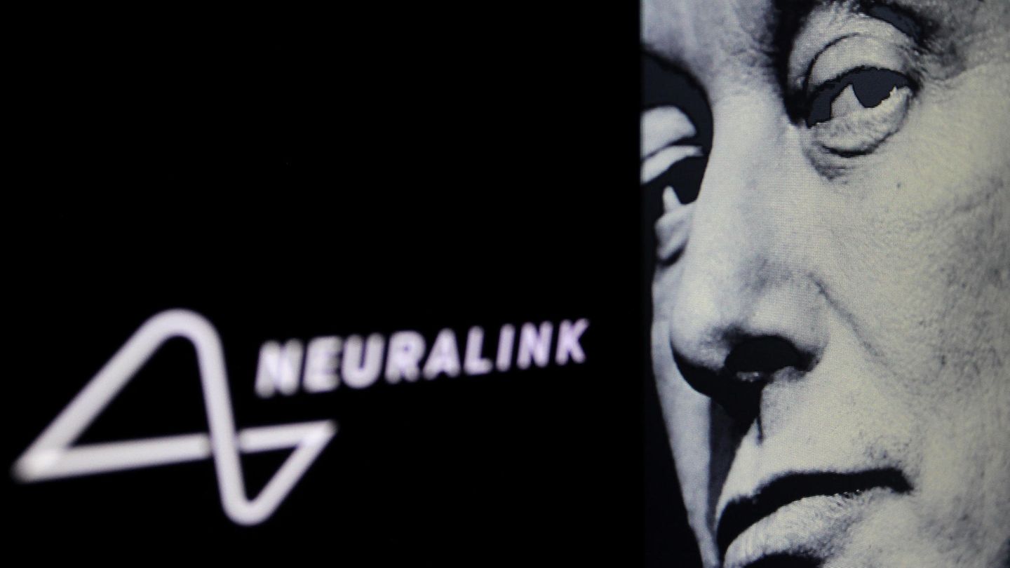 Elon Musk: Control computers with your thoughts – what can his company Neuralink do?