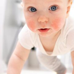 Das sind ausgezeichnete Ärzte im Bereich Neurodermitis