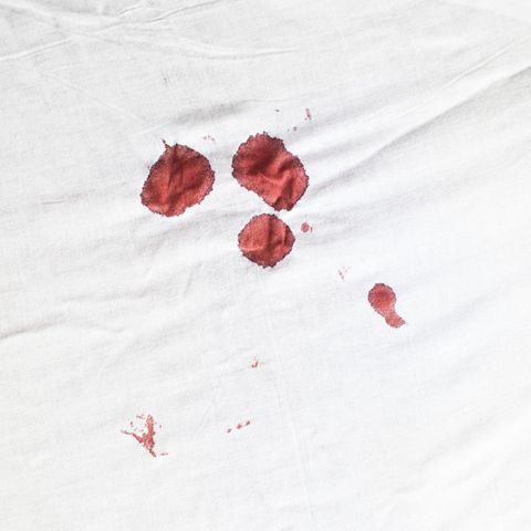 Starke Periode: Frauenärztin spricht über Ursachen und die richtige Therapie