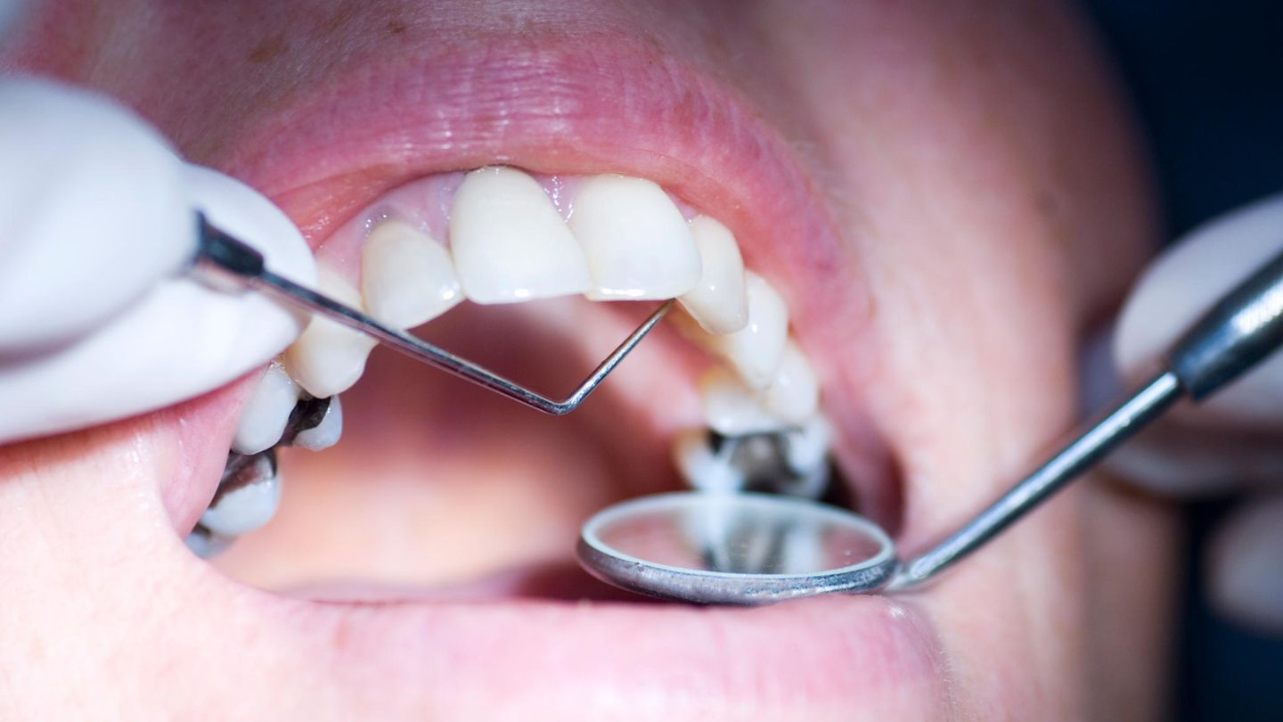 Amalgam fillings banned from 2025: How dangerous is hazardous waste in the mouth?