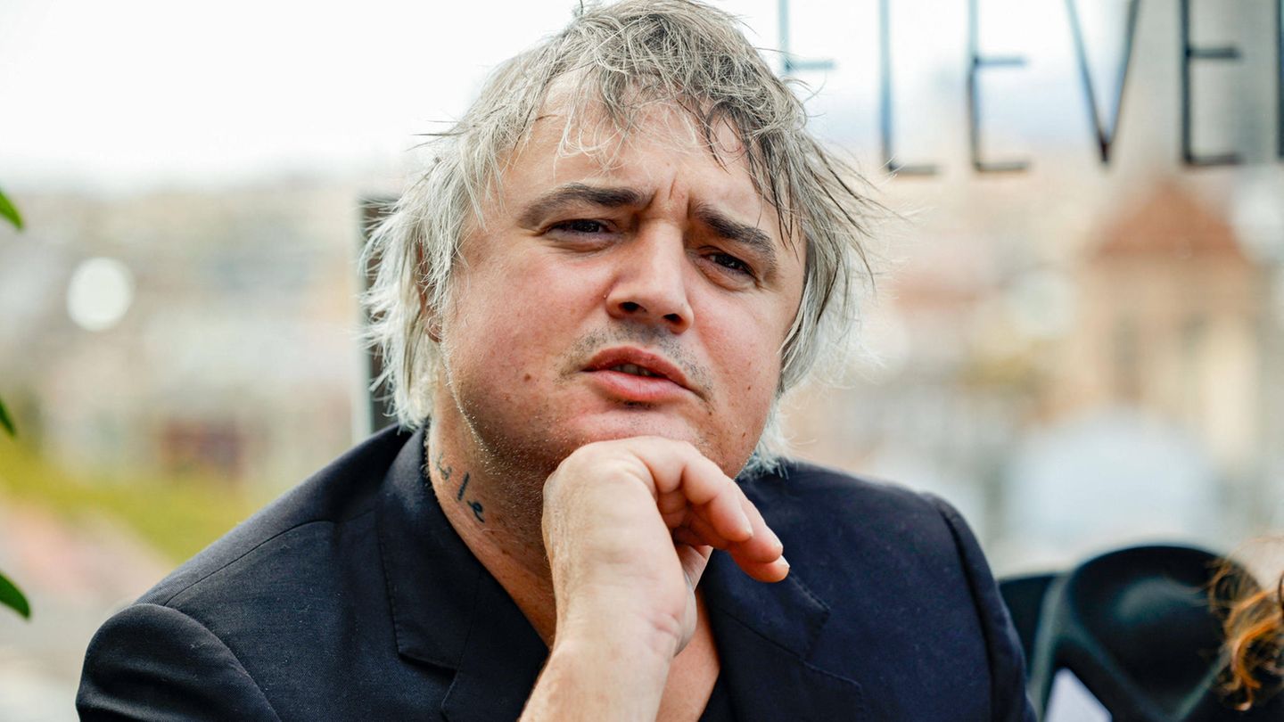 Pete Doherty has diabetes: “I was healthier when I was taking heroin”