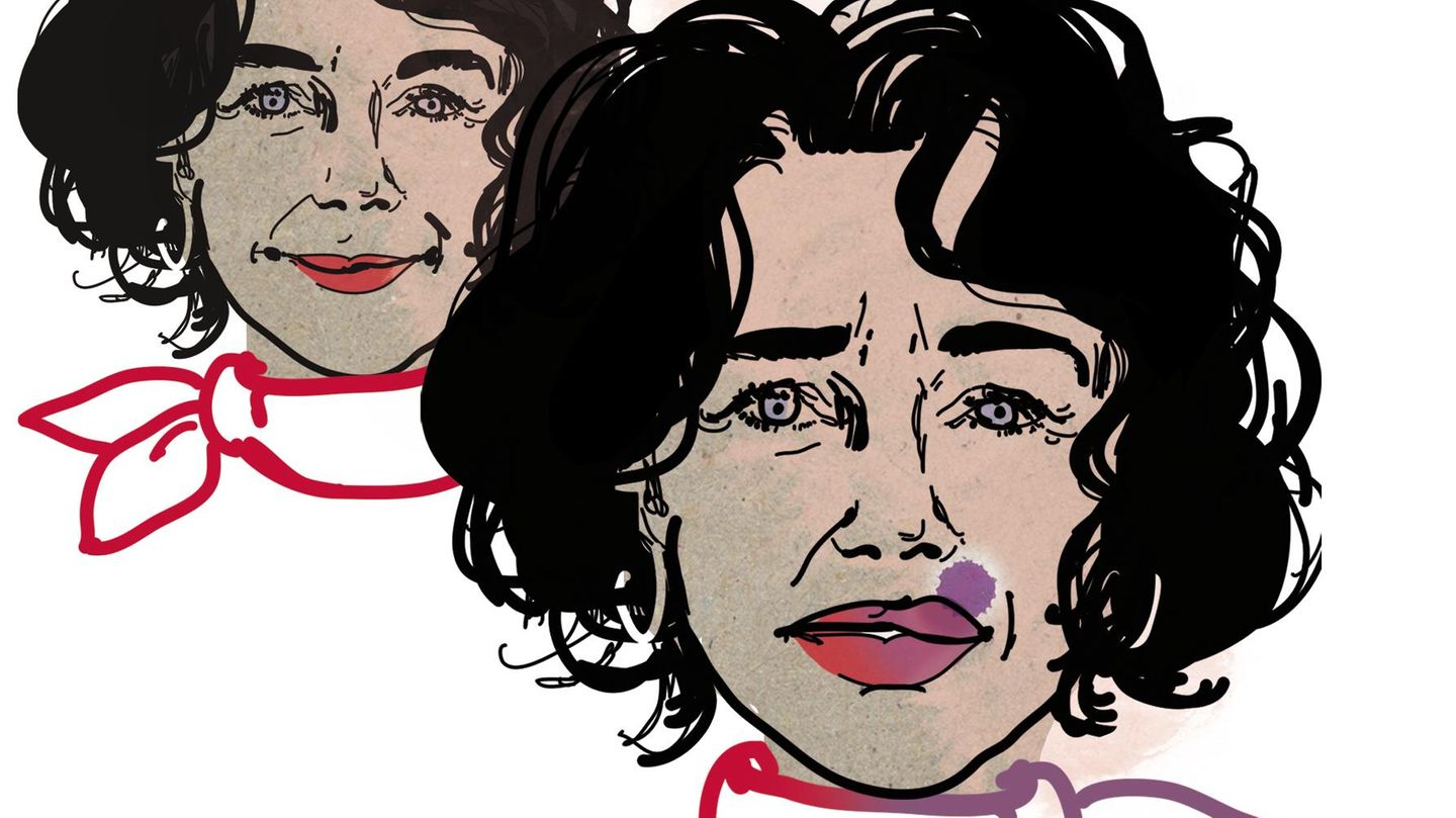 Illustration einer Frau, die sich die Lippen mit Hyaluronsäure hat behandeln lassen. Die Lippen sind dick und mit Fleck Illustration einer Frau, die sich die Lippen mit Hyaluronsäure hat behandeln lassen. Die Lippen sind dick und mit Fleck
