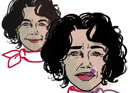 Illustration einer Frau, die sich die Lippen mit Hyaluronsäure hat behandeln lassen. Die Lippen sind dick und mit Fleck