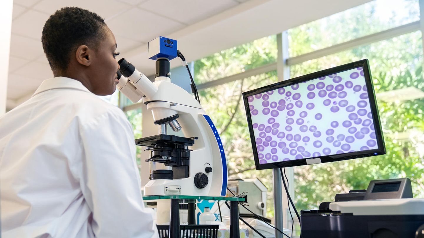 Bebilderung "Seltene Erkrankungen": In einem medizinischen Labor sitzt eine Frau vor einem Mikroskop  Bebilderung "Seltene Erkrankungen": In einem medizinischen Labor sitzt eine Frau vor einem Mikroskop