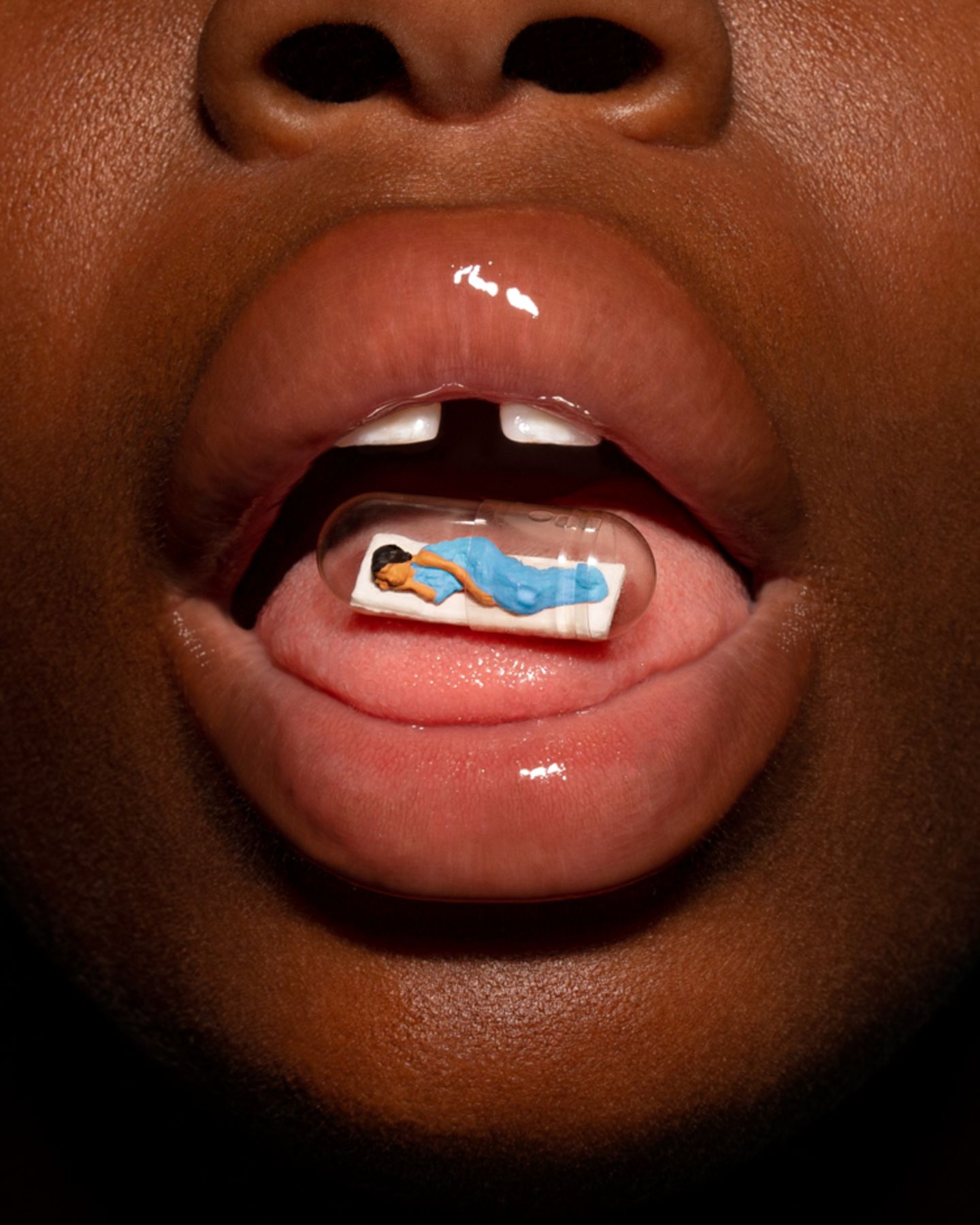 Nahaufnahme offener Mund mit Zahnlücke. Auf der Zunge liegt eine schlafende Miniaturfigur in winziger durchsichtigen Kapsel.