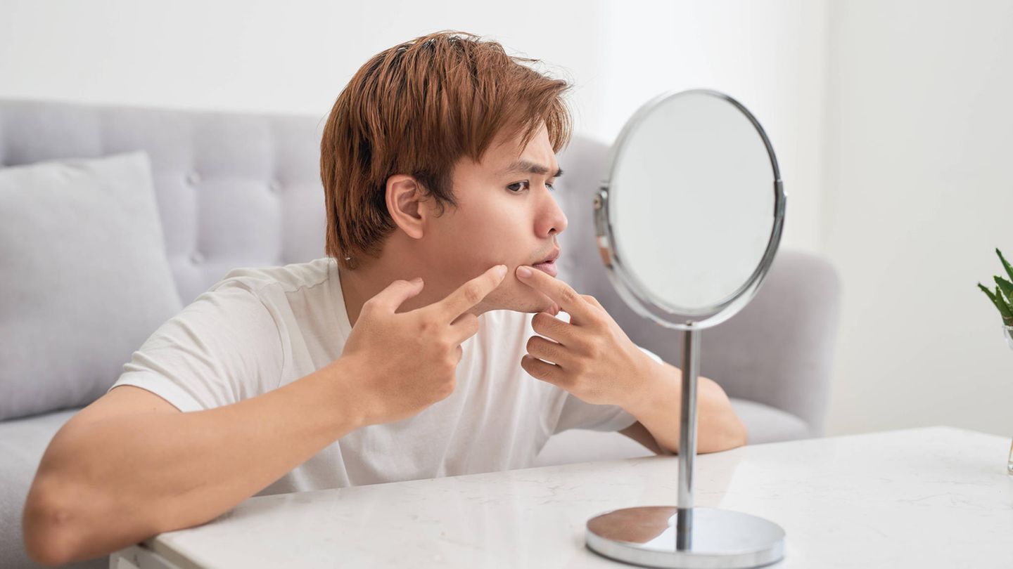 Pickel? Bloß nicht drücken! Pickel? Bloß nicht drücken!