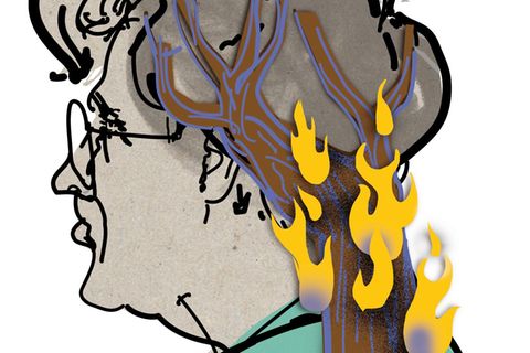 Illustration von Nackenschmerzen: Eine ältere Frau mit Flammen im Nacken