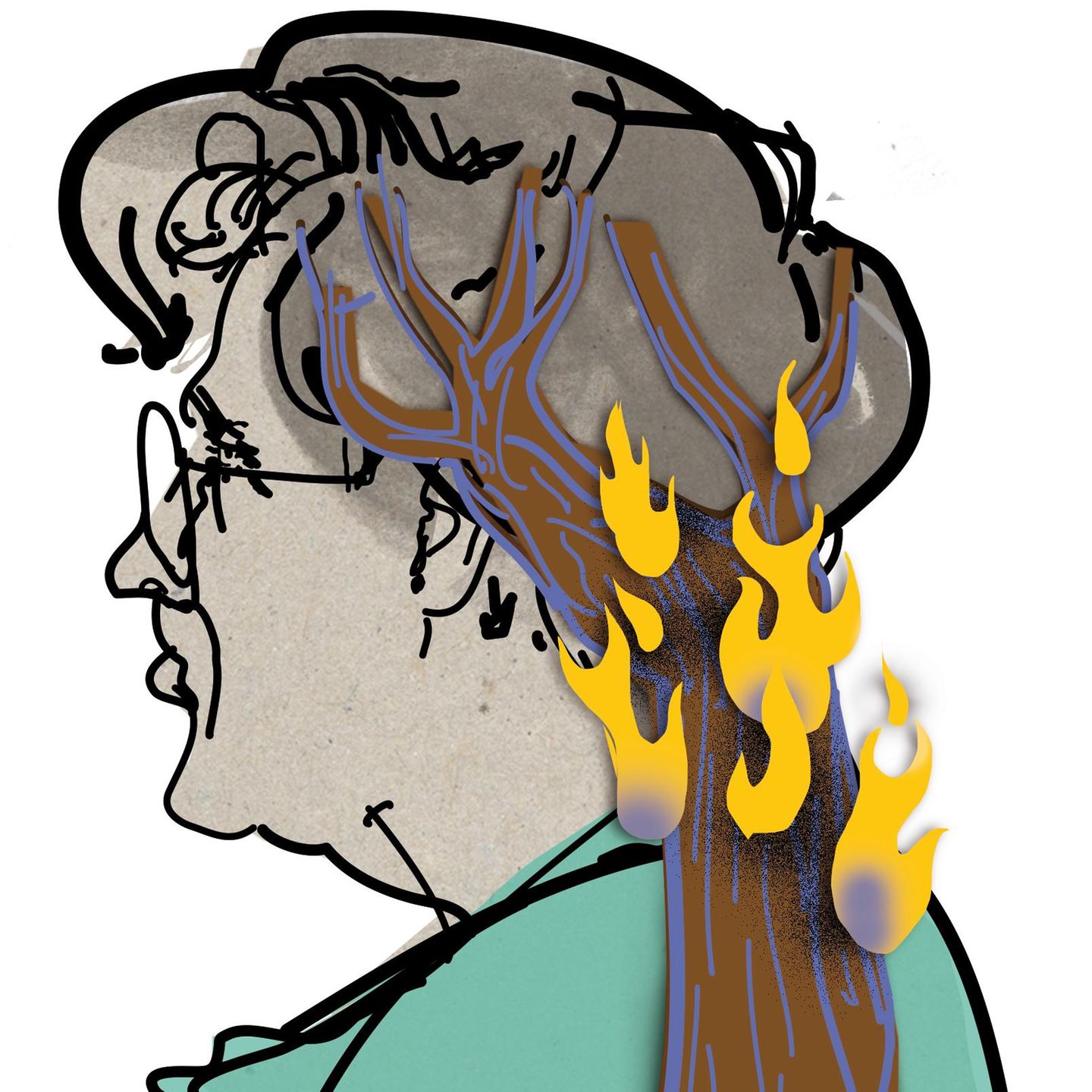 Illustration von Nackenschmerzen: Eine ältere Frau mit Flammen im Nacken