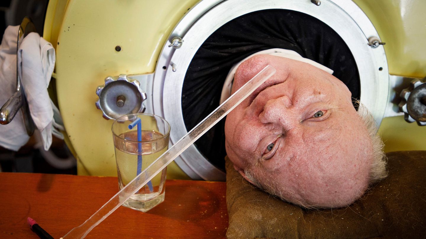 Paul Alexander lebt wegen einer Polio-Erkrankung seit Jahrzehnten in einer Eisernen Lunge