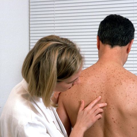 Vorsorge gegen Hautkrebs: Eine Ärztin schaut nach gefährlichen Veränderungen