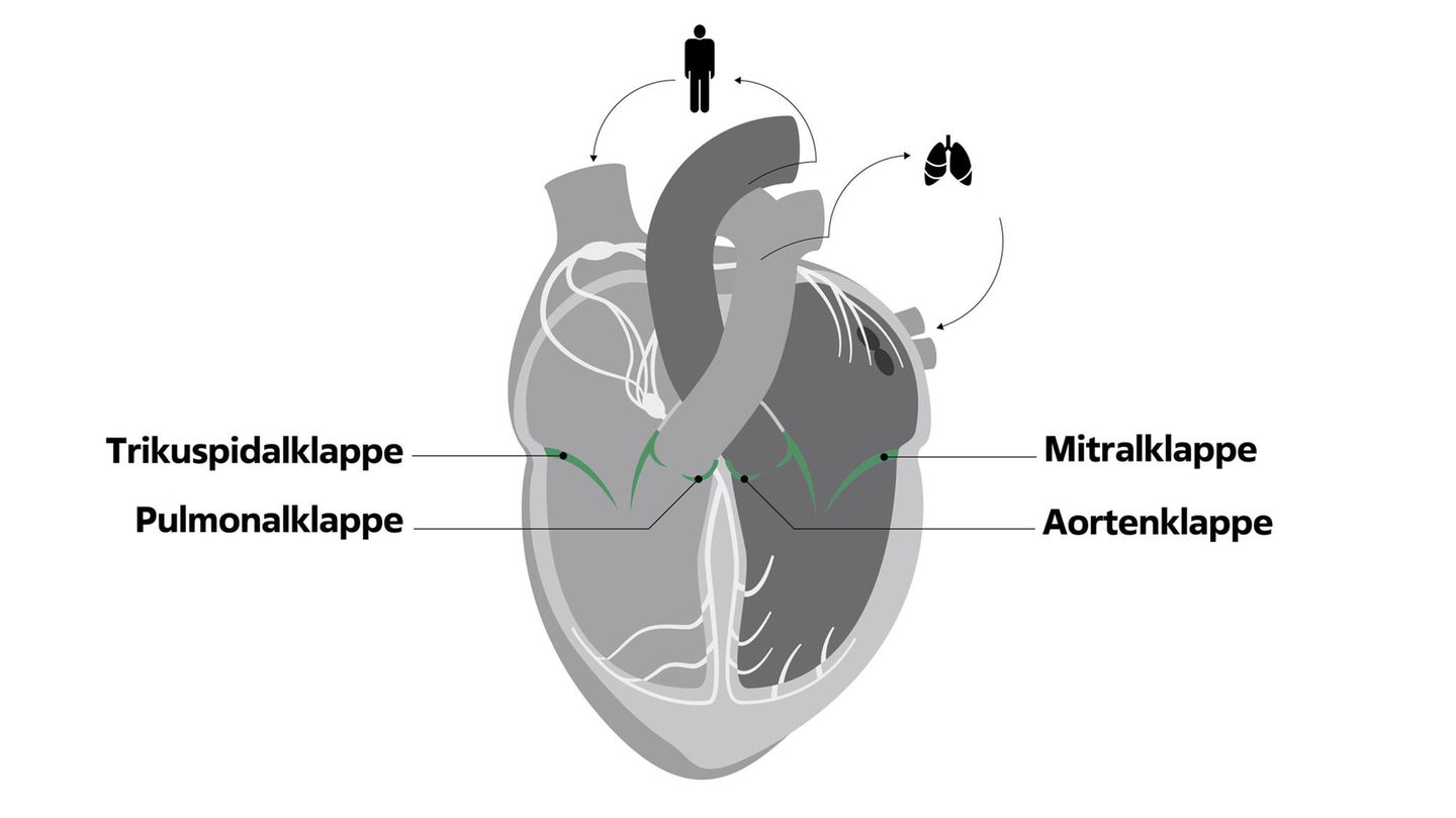 Infografik Herzklappen