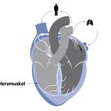 Infografik Herzmuskel
