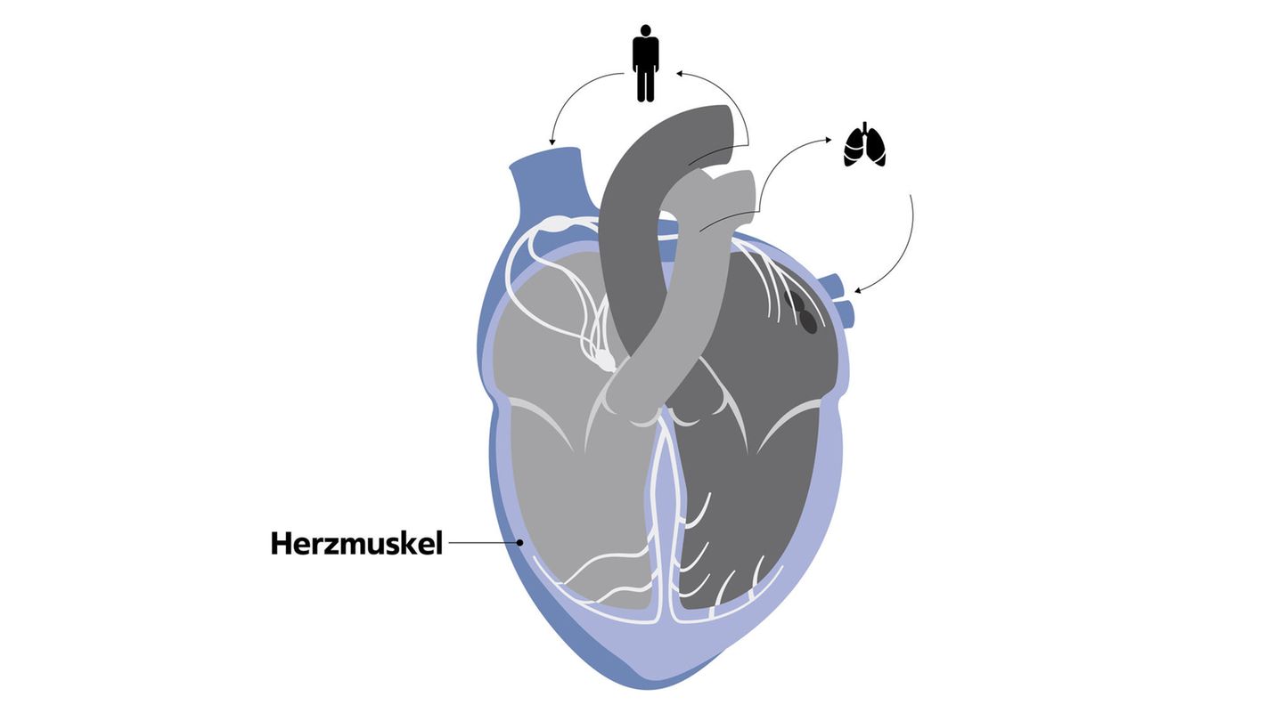 Infografik Herzmuskel