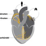 Infografik des Erregungsleitungssystems im menschlichen Herzen: Sinusknoten, AV-Knoten und Faserbündel im Herzen