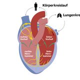 Infografik zum Aufbau des menschlichen Herzens