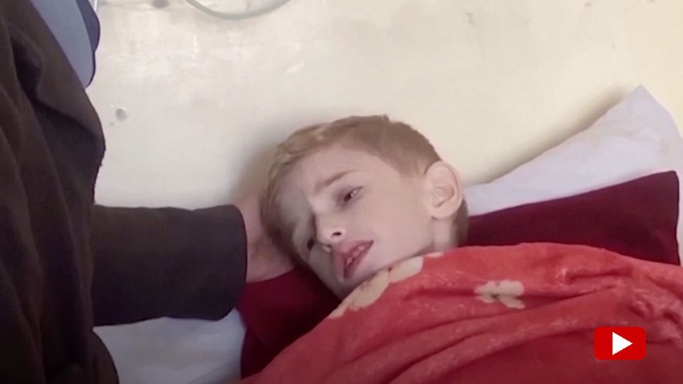 “The clock is ticking” – people like Fadi (6) are suffering from the famine in Gaza